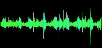 Radio Inteference